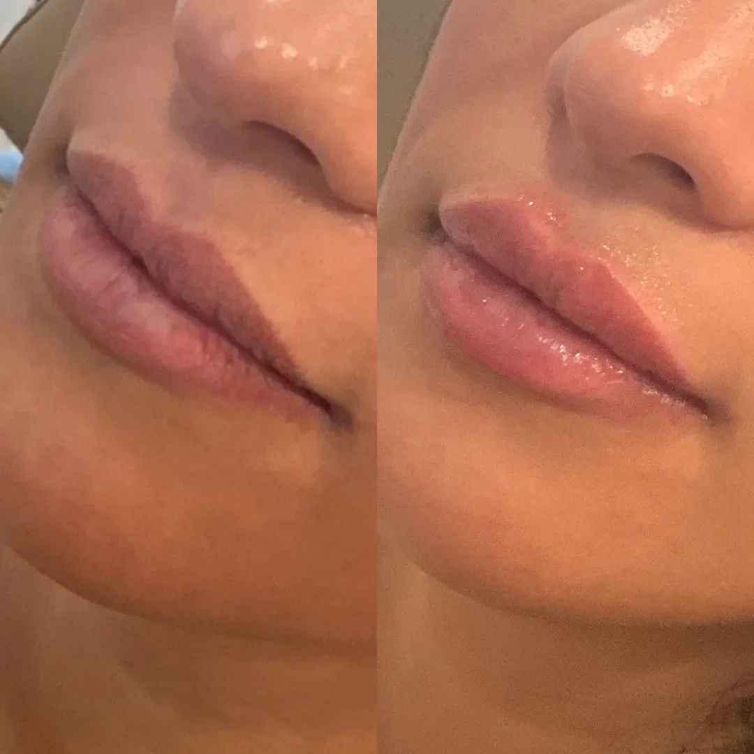 Julia B&A 2024 11.zip - 13_min