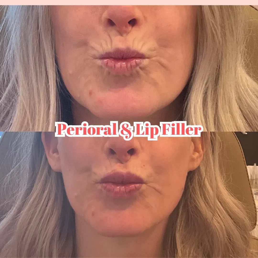 Julia B&A 2024 - Yes social_min