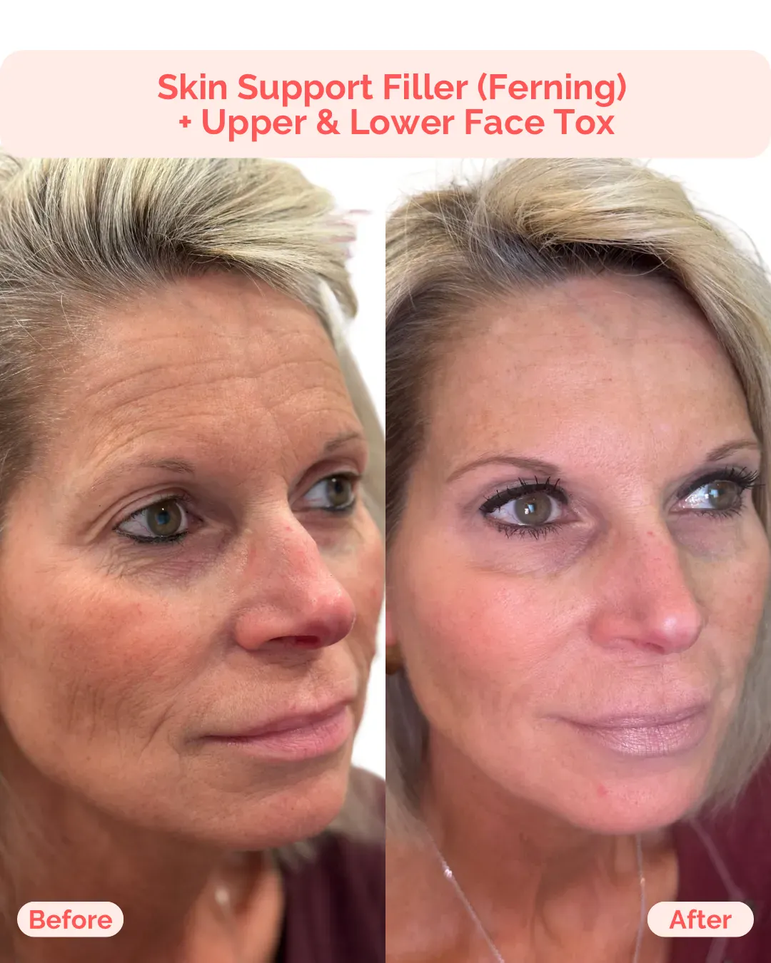 Julia B&A 2025 - 17_min