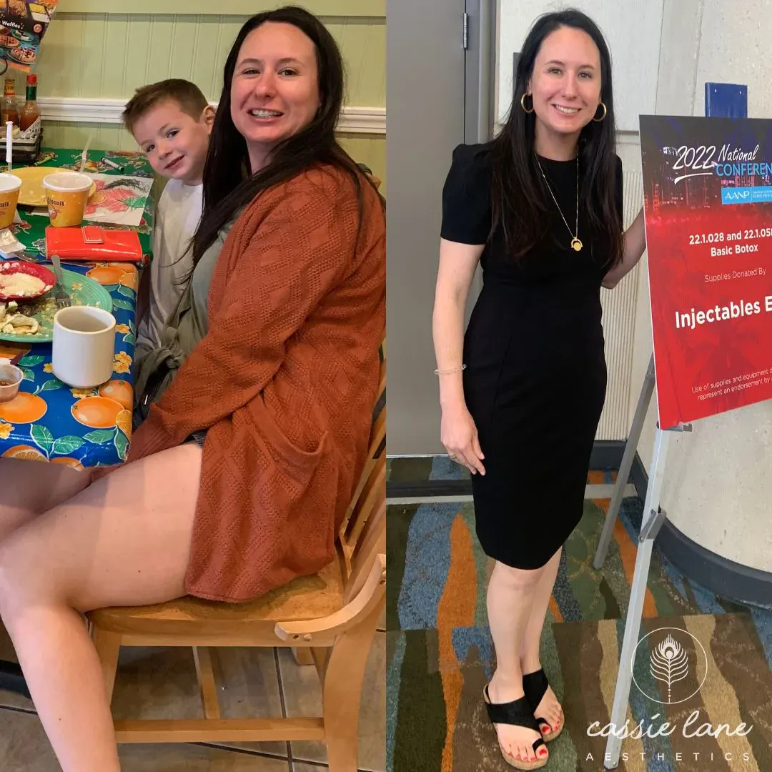 Medical Weight Loss Richmond VA