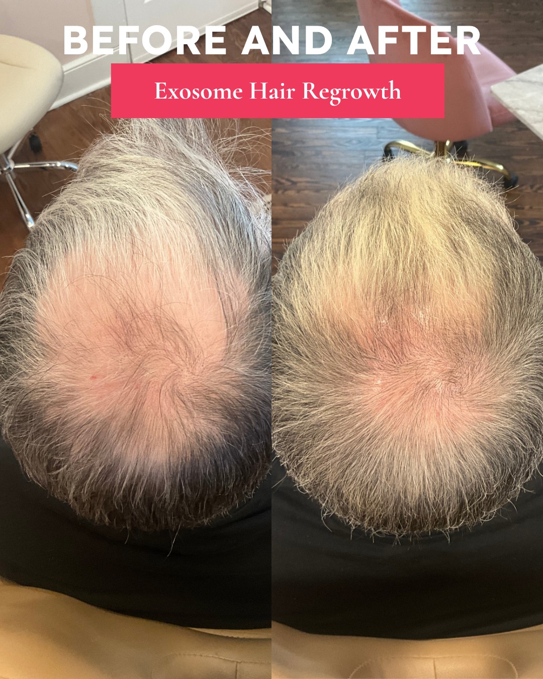 Regenerative Skin Treatment